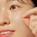 خرید پچ ضد جوش کوزارکس