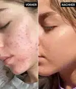 سرم نیاسینامید اینکی لیست 30میل Niacinamide Serum The INKEY List - Image 2