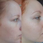 کرم افکلار کا پلاس لاروش پوزای مناسب پوست های چرب و مختلط +K - Image 2