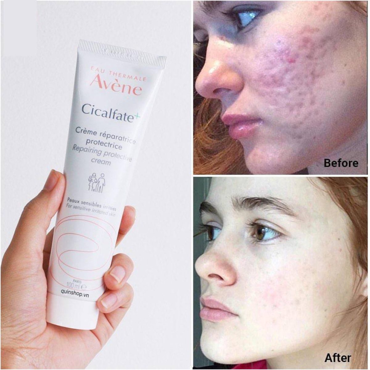 کرم سیکالفیت اون 100 میل avene cicalfate repair cream - Image 4