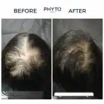 فیتو شامپو احیا کننده و درمان ریزش مو فیتوسیان PHYTOCYANE حجم 250 ميل - Image 2