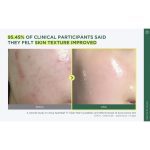 تونر پد دار پاک کننده و تسکین دهنده آنوا 160 میل ANUA Heartleaf 77% Clear Pad - Image 2