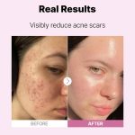 سرم نیاسینامید ۱۵ کوزارکس-COSRX The Niacinamide 15 Serum 20ml - Image 8