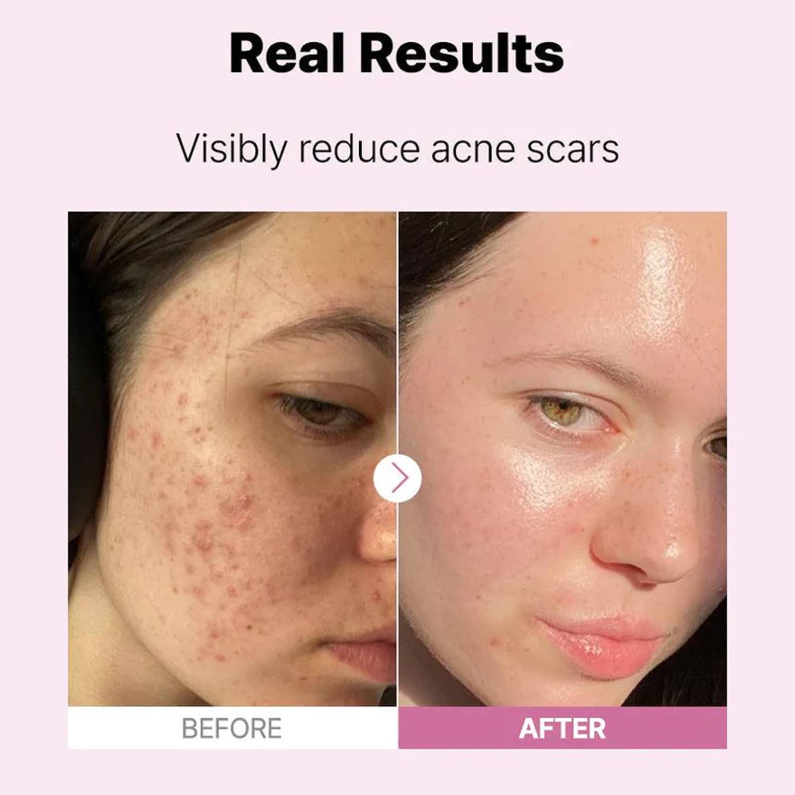 PRUDUCT_2-The_Niacinamide_15_Serum سرم نیاسینامید ۱۵ کوزارکس-COSRX The Niacinamide 15 Serum 20ml - Image 8