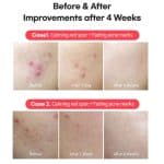 کرم نقطه ای ضد لک و جوش تیام 30 گرم TIA’M AC Fighting Spot RX Cream - Image 3