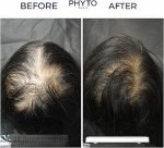 سرم فیتو ضد ریزش مدل فیتوسیان بانوان 87 درصد PHYTO PHYTOCYANE ANTI-HAIR LOSS VIAL SERUM FOR WOMEN 87% - Image 2