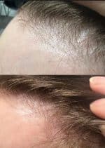 قرص پریورین بایر ضد ریزش آلمانی اصل  120 عددی PRIORIN - Image 2