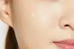 نحوه استفاده از پچ ضد آکنه کوزارکس