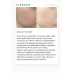 کرم ضد لک و روشن کننده ترانگزامیک اسید دکتر ملاکسین 50 گرم Dr.Melaxin TX Tranexamic Acid CREAM - Image 2