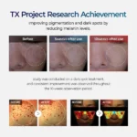 کرم ضد لک و روشن کننده ترانگزامیک اسید دکتر ملاکسین 50 گرم Dr.Melaxin TX Tranexamic Acid CREAM - Image 8