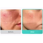 سرم تسکین دهنده آزلائیک اسید مدی کیوب 30 میل Medicube Azelaic Acid 16 BB Calming Serum - Image 5
