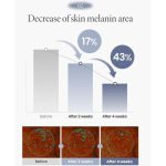 کرم ترانگزامیک اسید 2.5% اکسیس وای ضدلک و روشن کننده پوست حجم 50 میل AXIS-Y TXA 2.5% Intensive Brightening Cream - Image 8