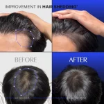 سرم اسکالپ محرک رشد مو لیلیوئه مدل پرایم حجم 100 میل Lilyeve GROW TURN EXOSOME Brush Ampoule Prime - Image 6